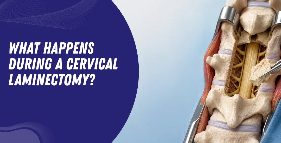 What Happens During a Cervical Laminectomy