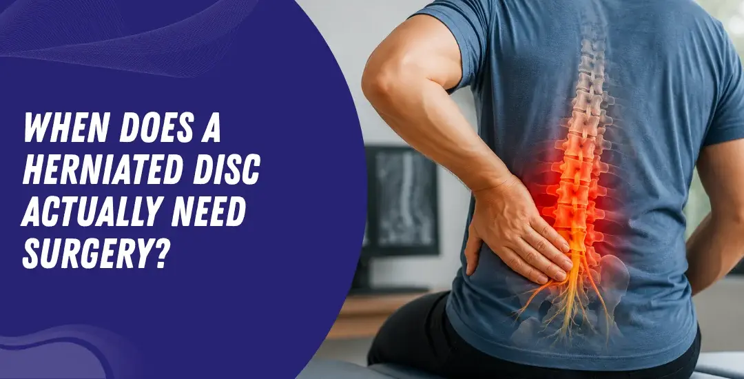 When Does a Herniated Disc Actually Need Surgery