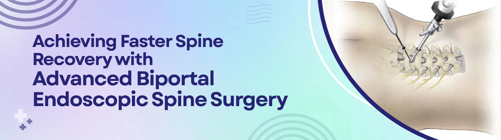 Achieving Faster Spine Recovery with Advanced Biportal Endoscopic Spine Surgery | drarvindumarani.in